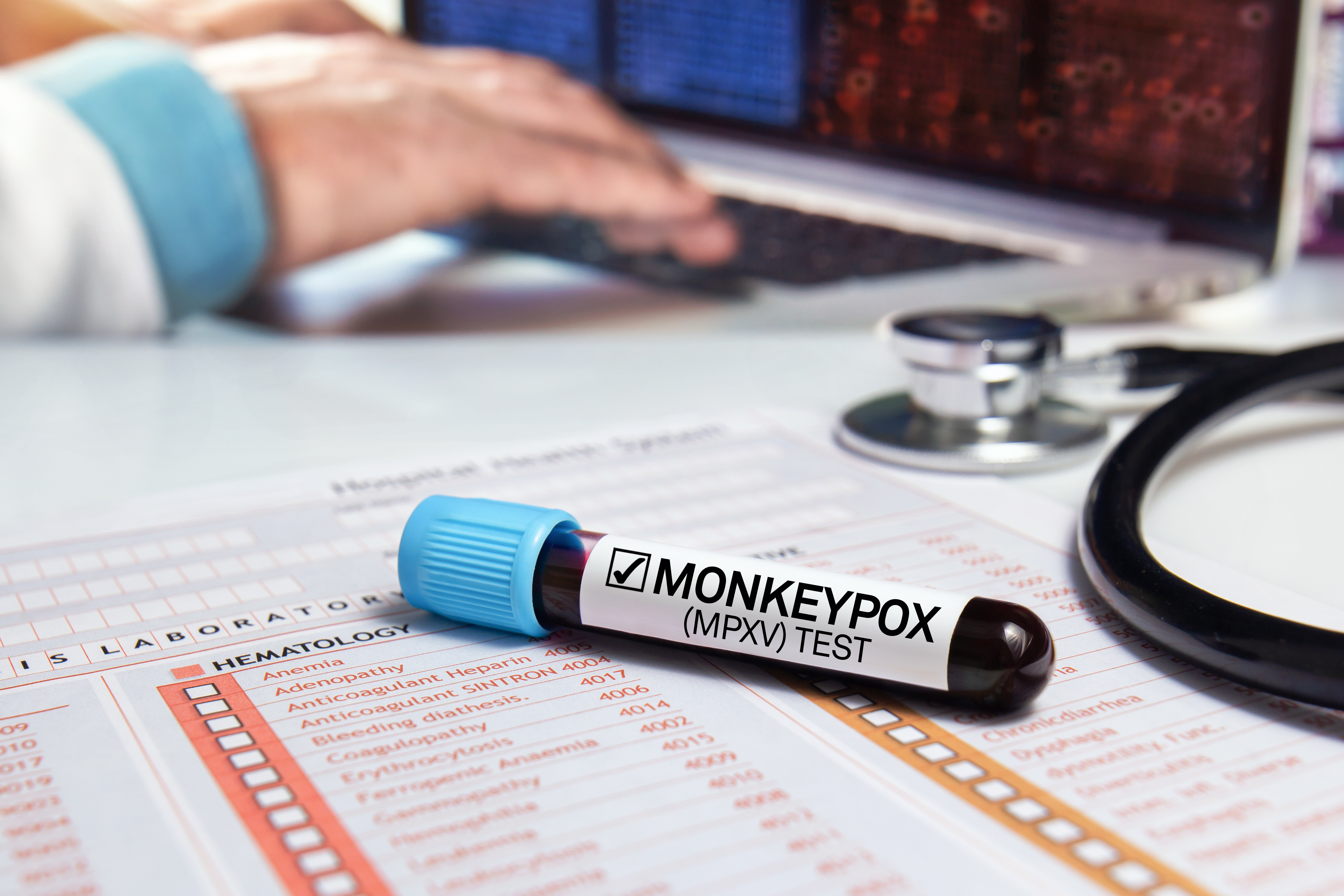 Monkeypox Resources