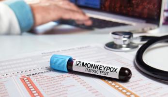 Monkeypox Resources 