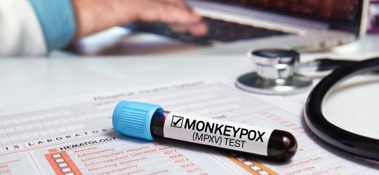 Monkeypox Resources 
